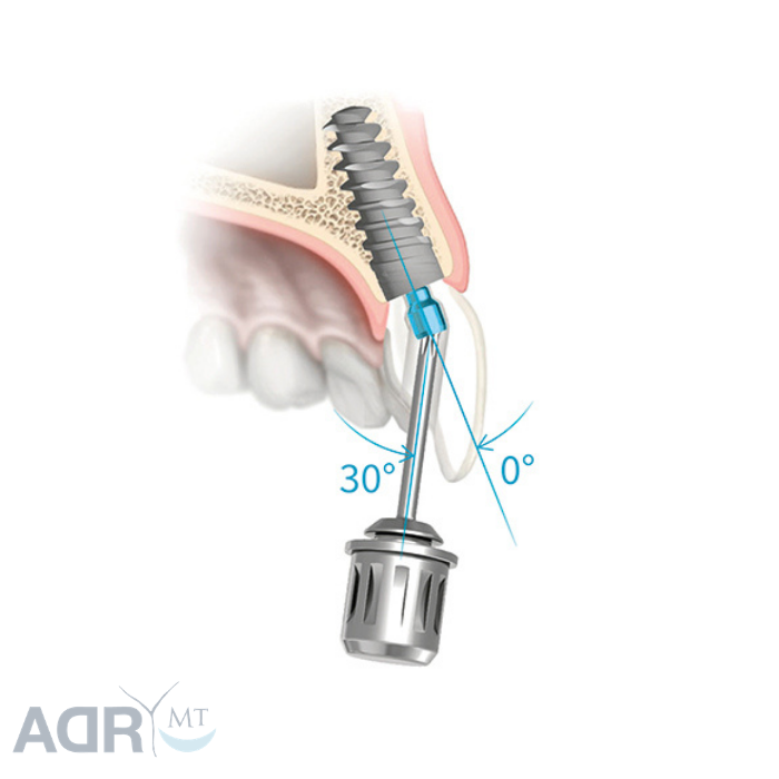 Cacciavite Angolato JD - ADR - Medical Training